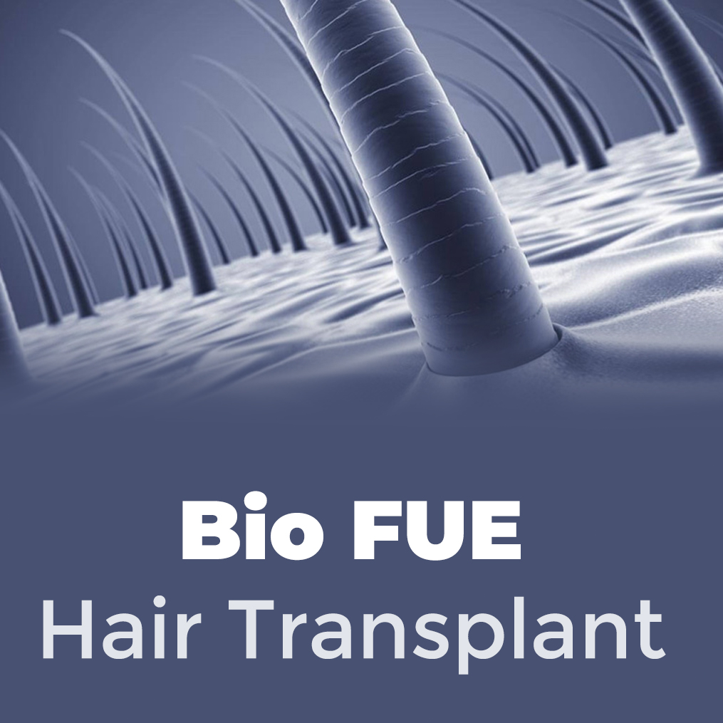 Bio Fue Hair Transplant