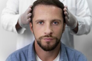 5 Key Factors That Influence The Success Of Hair Transplant