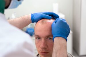 Rejuvenate Your Hairline: The Science of Hair Transplantation