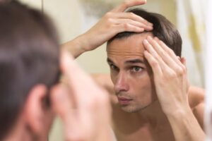 Aftercare Tips for A Successful Hair Transplant Recovery