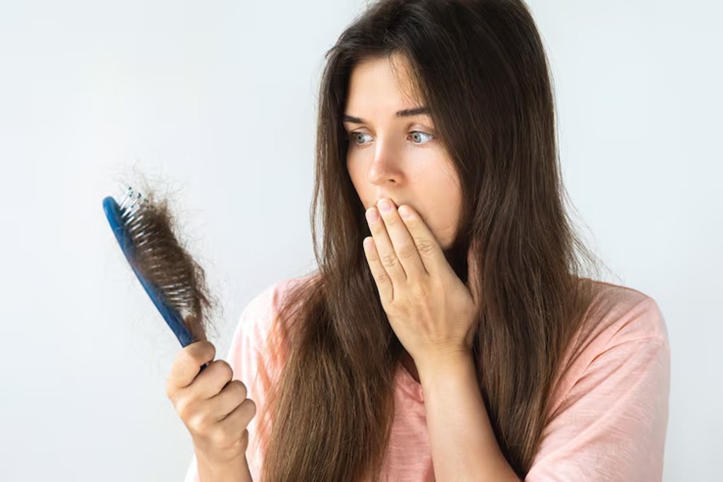 Hair Loss in Women